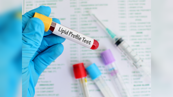 Blood test results showing lipid markers
