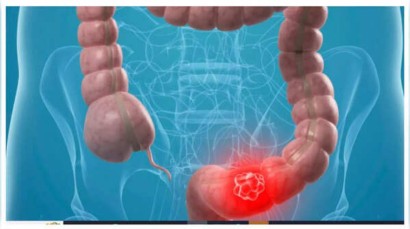 Recognizing abdominal pain as a possible early sign